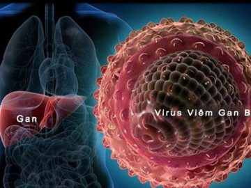 Viêm gan B: Nguyên nhân, triệu chứng và các con đường lây nhiễm