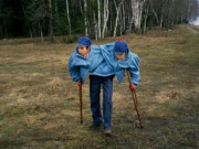 Tin tức - Cặp song sinh dính liền nổi tiếng nhất thế giới: 50 năm làm 'chuột bạch' và cái kết bi kịch