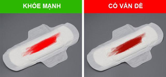 8 dấu hiệu tưởng nhẹ nhưng cảnh báo bệnh phụ nữ không hề đơn giản - 5