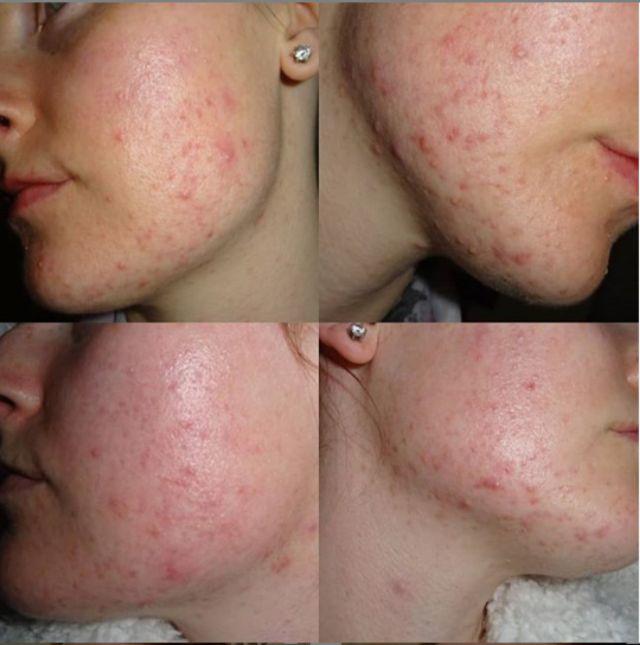 8 dấu hiệu tưởng nhẹ nhưng cảnh báo bệnh phụ nữ không hề đơn giản - 2