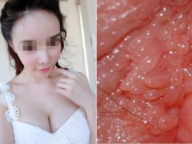 Mắc bệnh tình dục ở tuổi 22, cô nhân viên ngân hàng chết ngất khi bác sĩ nói lý do