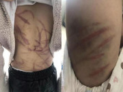 Tin tức - Bé gái 10 tuổi nói với hàng xóm: "Người con đau quá" hé lộ tội ác tày trời của bố