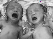 Bà bầu - Mẹ Hà Nội 22 năm mỏi mắt tìm con, mang bầu đôi chân lại phù không rõ nguyên nhân