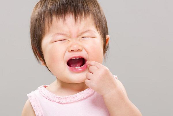 Trẻ mọc răng hàm: Thứ tự mọc răng và cách chăm sóc - 3