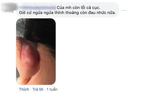 sua mui dep xong den tai bi di dang, cong cuoc “len doi” nhan sac sao ma gian nan qua! - 7