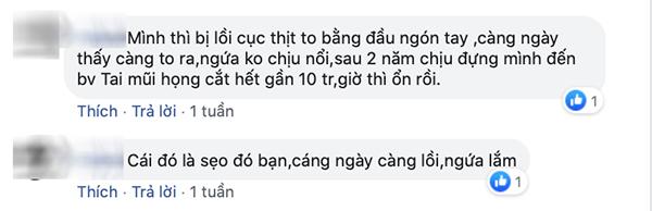 sua mui dep xong den tai bi di dang, cong cuoc “len doi” nhan sac sao ma gian nan qua! - 6