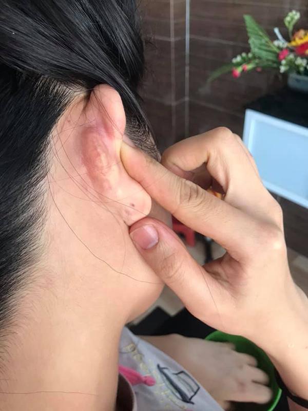 sua mui dep xong den tai bi di dang, cong cuoc “len doi” nhan sac sao ma gian nan qua! - 4