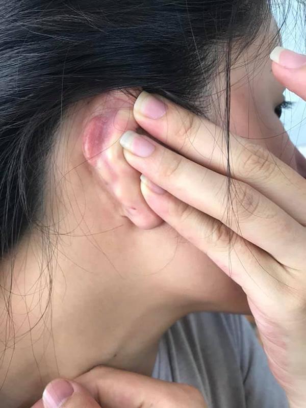 sua mui dep xong den tai bi di dang, cong cuoc “len doi” nhan sac sao ma gian nan qua! - 3