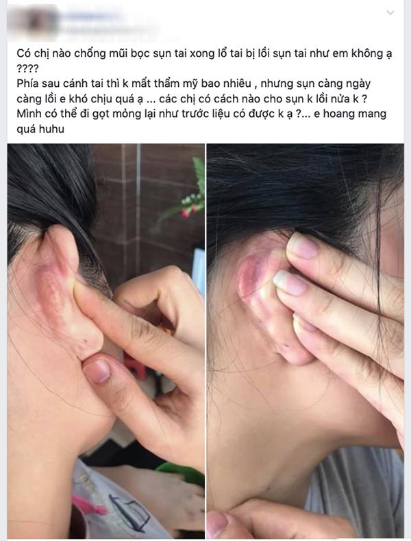 sua mui dep xong den tai bi di dang, cong cuoc “len doi” nhan sac sao ma gian nan qua! - 2