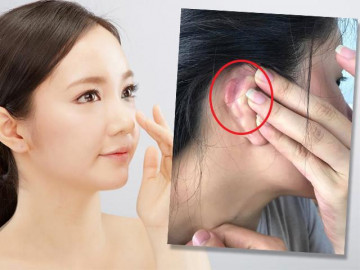 Sửa mũi đẹp xong đến tai bị dị dạng, công cuộc lên đời nhan sắc sao mà gian nan quá!