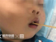Sức khỏe - Cậu bé 3 tuổi suýt mất mạng khi ăn xúc xích, cha mẹ chăm sóc trẻ hết sức lưu ý
