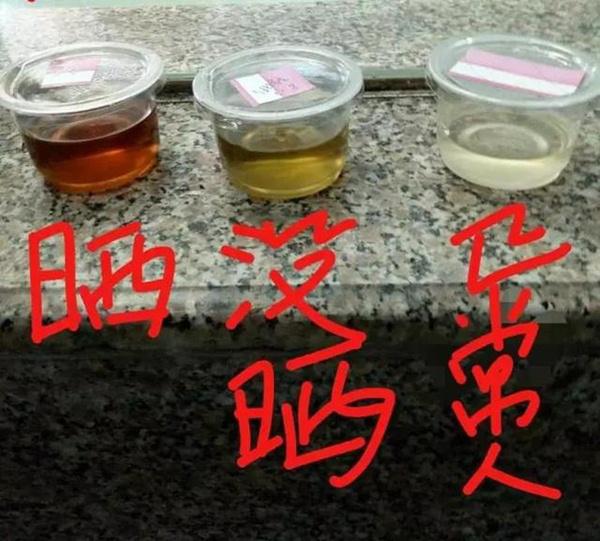 Thai phụ nhập viện vì xuất huyết não, cư xử bất thường, tiết lộ của mẹ đẻ gây sững sờ - 2