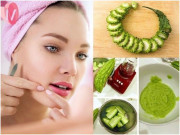 Làm đẹp - 28 Mặt nạ trị mụn tốt nhất từ nguyên liệu tự nhiên an toàn và hiệu quả