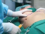 Sức khỏe - Nữ doanh nhân nhập viện khẩn cấp vì biến chứng sau ca nâng ngực ở nước ngoài