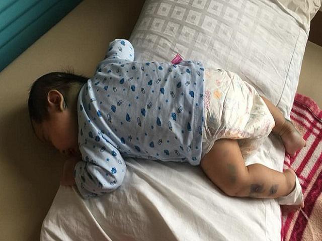 Mẹ Phú Thọ lo ngay ngáy vì vỡ kế hoạch, em bé vừa lọt lòng đã gánh đủ thứ bệnh