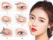 Làm đẹp - Cắt mí mắt và những kiến thức cần biết để tránh hậu quả khôn lường