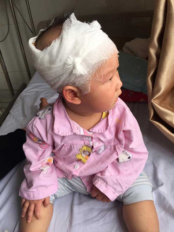 chu quan voi mun o dau con, me ha noi hoi han khong kip luc bac si noi benh tinh - 1