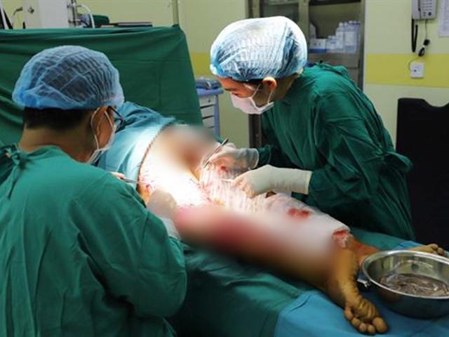 Không để ý vết xước ở tay khi làm thịt lợn, người phụ nữ bị suy đa tạng nghiêm trọng