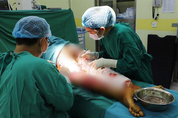 khong de y vet xuoc o tay khi lam thit lon, nguoi phu nu bi suy da tang nghiem trong - 1