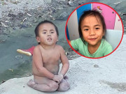 Tin tức - Bất ngờ hình ảnh mới của bé Pàng liệt chân, không manh áo giữa trời đông từng ‘dậy sóng’ MXH