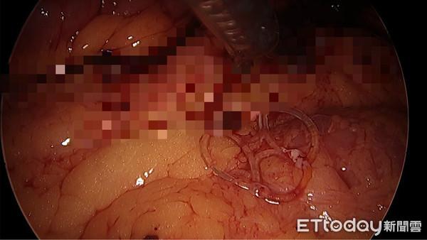 5 co quan noi tang cua nguoi phu nu dinh vao nhau vi quen mot thu chi em deu quen - 2