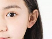 Sức khỏe - Hai đứa trẻ gần như bị mù, thủ phạm là một loại ký sinh thường thấy ở chó mèo