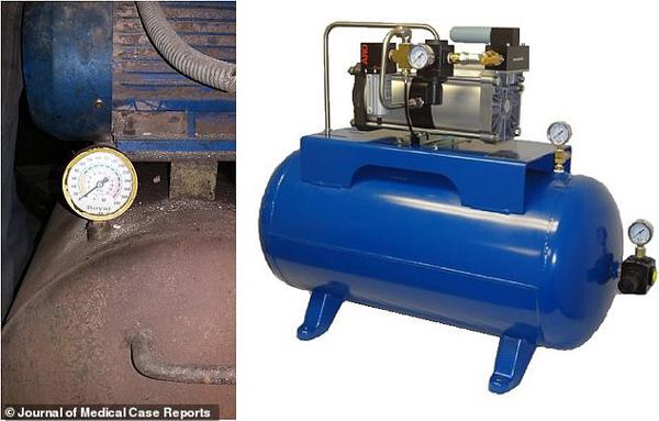 nguoi dan ong bi no tung truc trang vi ban nhet thu nay vao hau mon - 1