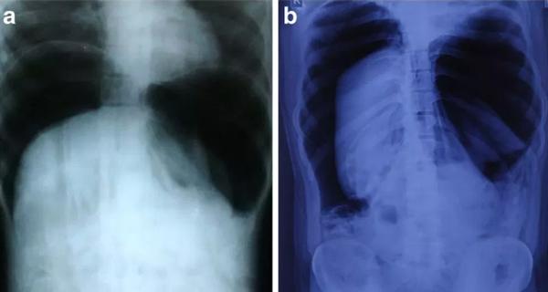 nguoi dan ong bi no tung truc trang vi ban nhet thu nay vao hau mon - 2