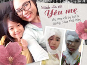 Làm mẹ - Mặt biến dạng, chết lâm sàng vì chồng tạt acid, cô giáo xinh đẹp bật khóc nghe con gái nói