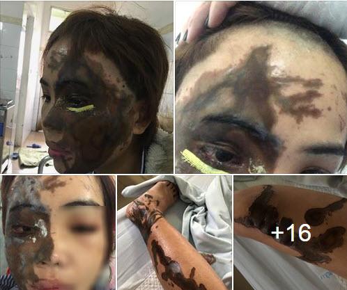 noi xot xa, dau don cua co gai da nang bi ban trai tat a xit truoc ngay cuoi - 1