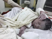 Tin tức - Hú hồn vì chuộng bệnh viện tuyến trên mà đi xa, sản phụ suýt đẻ rơi con ra đường