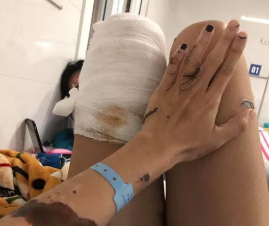 vu thieu uy cong an tat axit vo sap cuoi o da nang: doi tuong len ke hoach ra sao? - 1