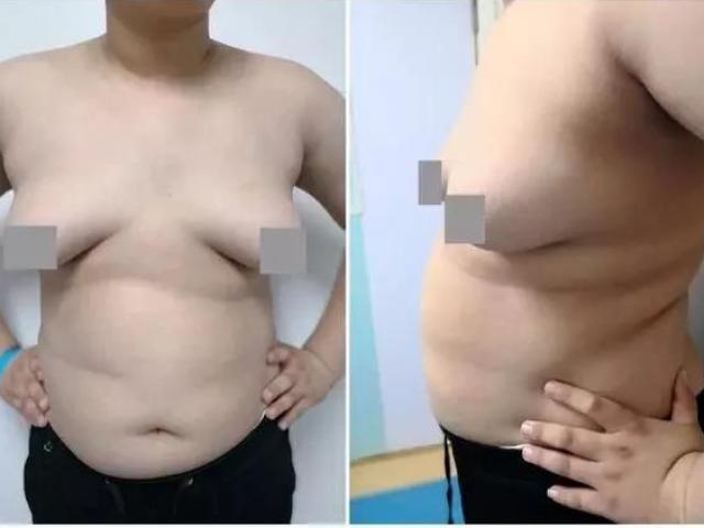 Ngực khủng hơn cả phụ nữ, hai chàng trai trẻ bị chị em xa lánh, không ai dám yêu