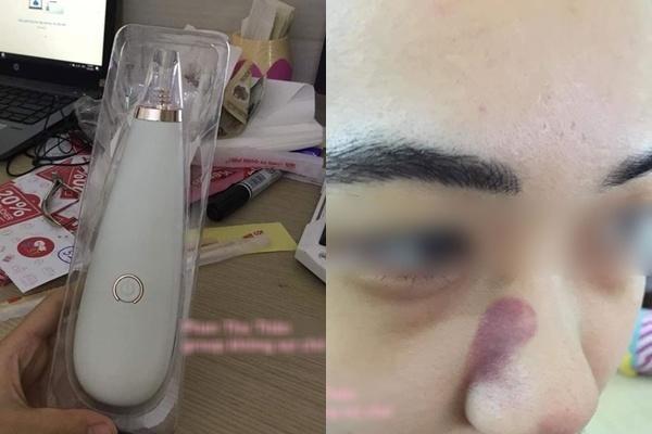 "tu xu" mun cung dau voi may hut mun cam tay, co gai nhan cai ket... dang long! - 3