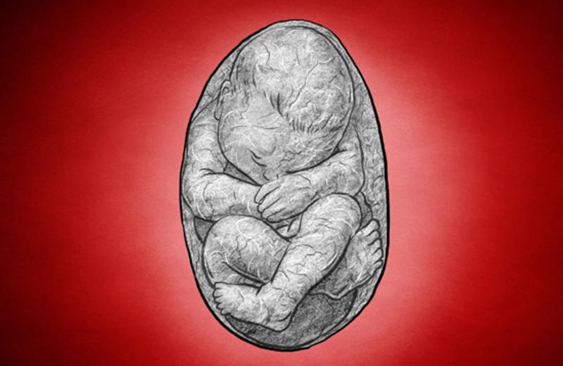 Có một điểm chung của những ca mang thai hóa đá là hầu hết các bà mẹ đều không biết mình mang thai hoặc thai nhi bị chết lưu khi còn quá nhỏ trong bụng mẹ khiến người mẹ không hề biết sự tồn tại của bé. 
