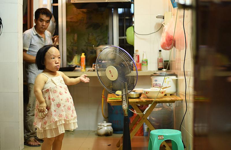 Câu chuyện mang bầu của bà mẹ khiếm khuyết nhưng đầy nghị lực Vi Xuân Lan (33 tuổi, sống tại Thượng Lâm, Nam Ninh, Trung Quốc) từng khiến nhiều người rơi nước mắt vì xúc động và cảm phục. 

