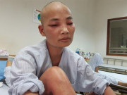 Tin tức - Mẹ ung thư người đỏ như tôm luộc, chỉ ước có đủ 1,4 triệu đồng để con không thất học