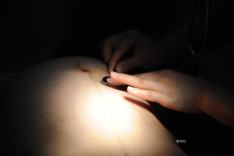 Bác sĩ phẫu thuật kiểm tra tim thai lần cuối trước khi mổ. Sau đó sẽ tiến hành xác định vị trí sẽ rạch trên bụng thai phụ, ánh đèn chiếu chính xác vào vị trí sẽ mổ. 
