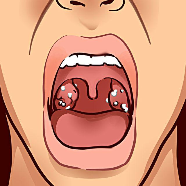 mieng boc mui canh bao 9 van de suc khoe khong he don gian, can kham gap - 1