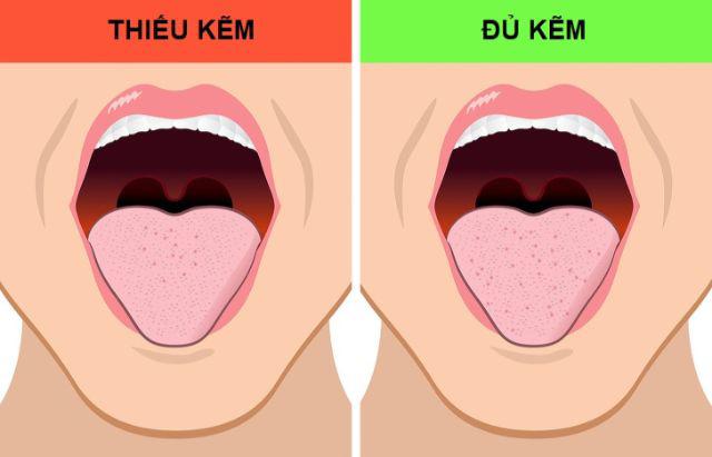 mieng boc mui canh bao 9 van de suc khoe khong he don gian, can kham gap - 3