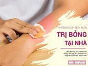 Sức khỏe - Những mẹo trị bỏng đơn giản ở ngay trong bếp nhà bạn mà hiệu quả bất ngờ