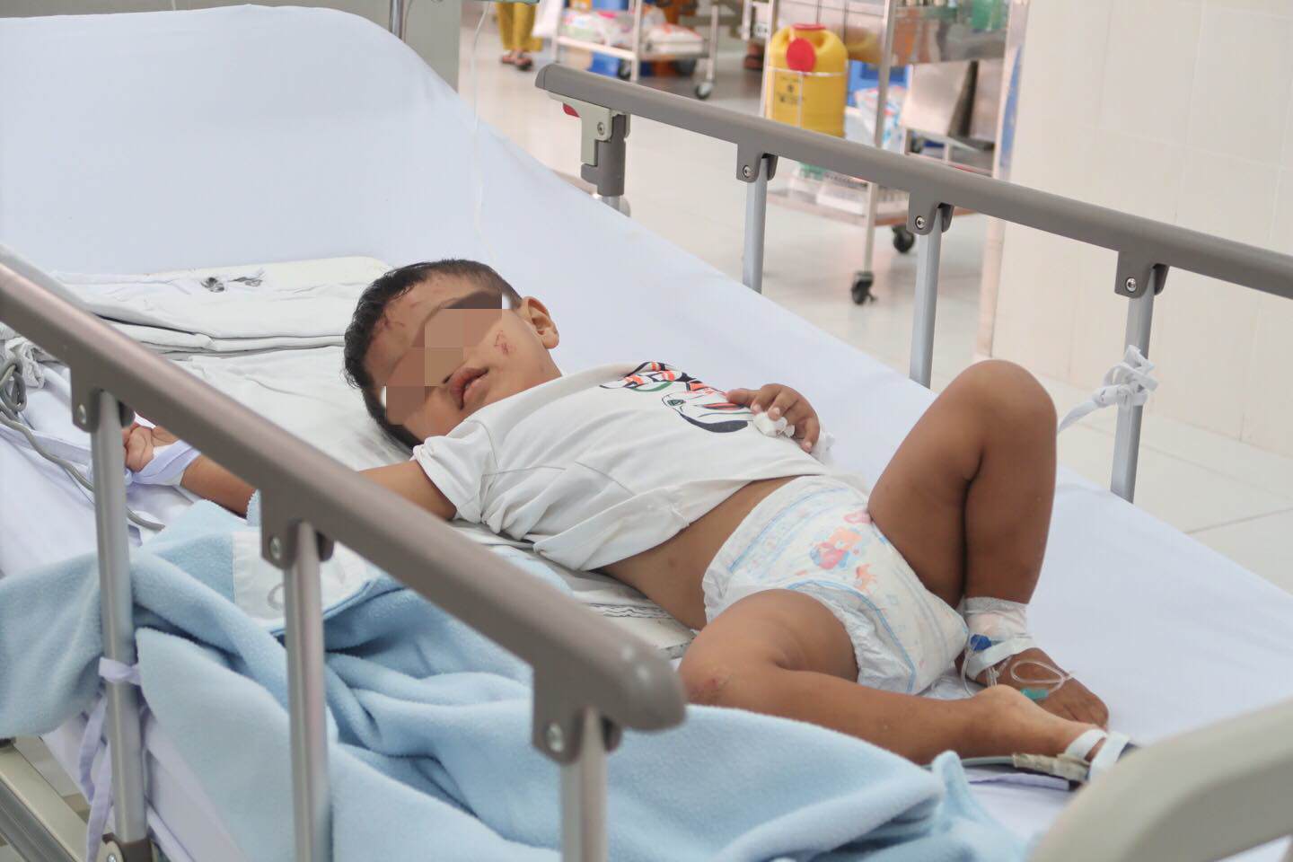 Con thiệt mạng vì ngã cầu thang, cảnh báo những tai nạn nguy hiểm trẻ dễ gặp ngày hè - 1