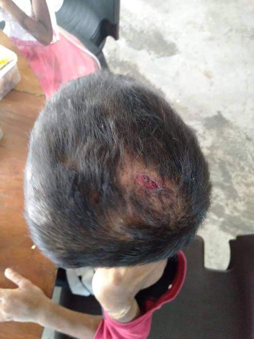 Bố mẹ ly hôn, 2 đứa trẻ bị người thân bỏ đói, hành động của chị họ gây ngỡ ngàng - 2