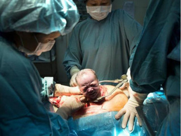 Sinh mổ lần 2 cách lần 1 bao lâu, các mẹ hãy nghe giải thích của bác sĩ phụ khoa