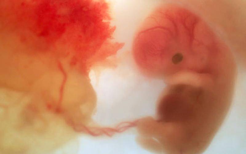 Lúc này kích thước của em bé đã được khoảng 1-1,3cm. Mí mắt và đôi tai của thai nhi đang thành hình, và mẹ bầu đã có thể trông thấy đầu mũi thai nhi thông qua ảnh siêu âm. 
