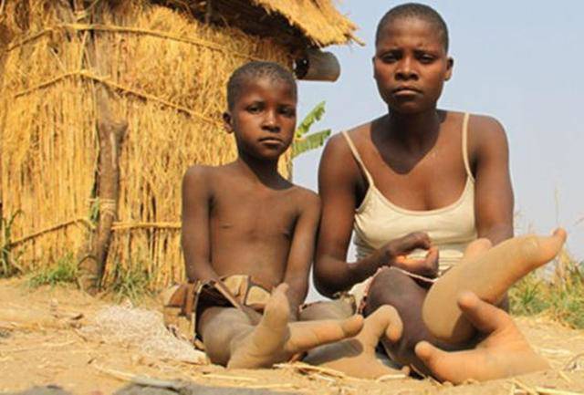 Bộ lạc amp;#34;chân đà điểuamp;#34; kỳ lạ ở châu Phi - 5