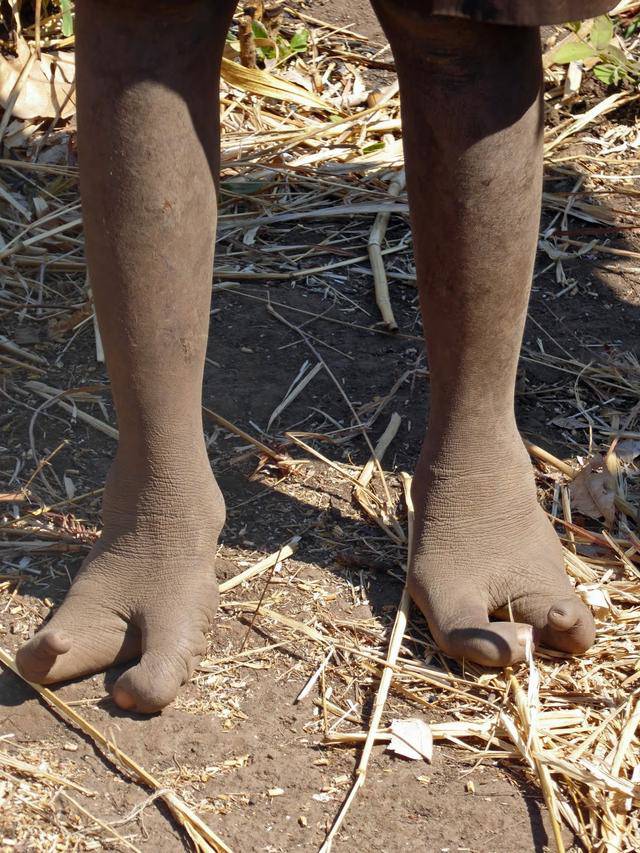 Bộ lạc amp;#34;chân đà điểuamp;#34; kỳ lạ ở châu Phi - 4