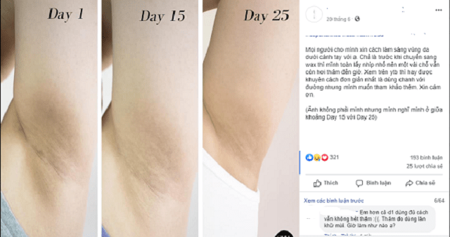 Ngoài “vi-o-long”, da dưới vùng nách đen sạm sần sùi là do bạn chưa biết những điều này - 2