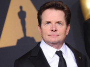 Sức khỏe - Nam diễn viên vượt qua bệnh Parkinson, sống tới gần 60 tuổi dù được đoán chỉ sống 3 năm