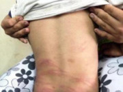 Tin tức - Hà Nội: Bé 3 tuổi tử vong nghi do bị mẹ ruột và bố dượng bạo hành như thời Trung cổ